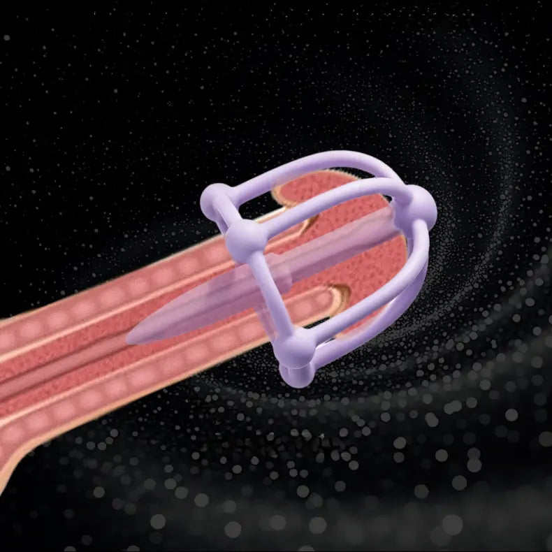 Anti-Detachment Cage Sounding Rod